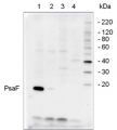 PsaF | PSI-F subunit of photosystem I (plant)